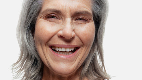 Skin aging - does our bacteria play a crucial role?